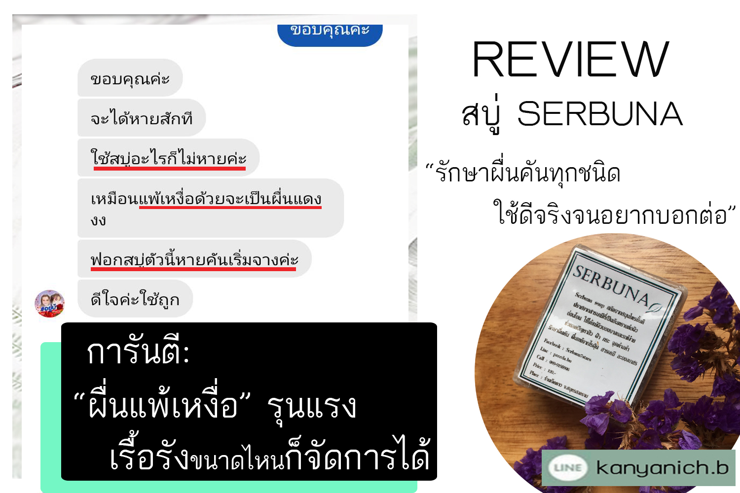 แพ้เหงื่อ1